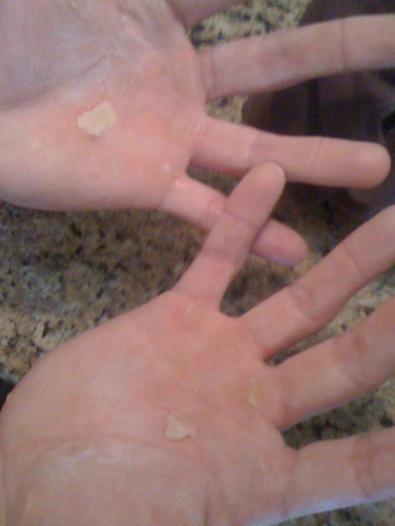 Torn Hands Img_1799_entry