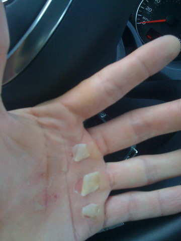 Ripped Left Hand Img_1994_entry