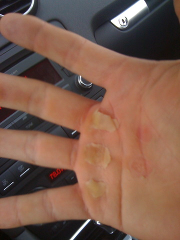 Ripped Right Hand Img_1995_entry