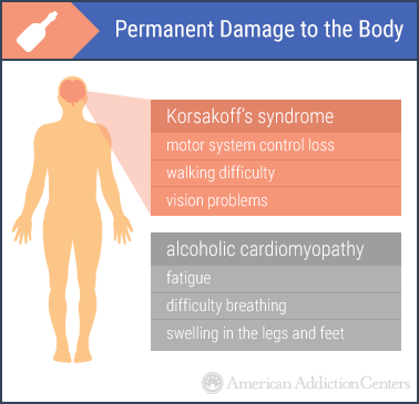 alcohol permanent damage