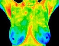 FDA warns doctor: Stop touting camera as disease screening tool FDA warns doctor: Stop touting camera as disease screening tool