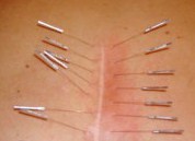 Scare Removal Therapy