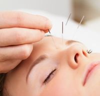 Santa Barbara Cosmetic Acupuncture