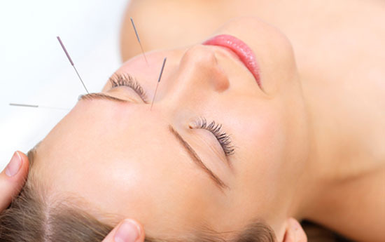 Cosmetic Acupuncture Cosmetic Acupuncture