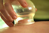 Chinese Medicine Cupping Fire Cupping