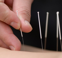 In this expanding holistic universe, Acupuncture is a key player... Huffington Post