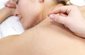 Acupuncture