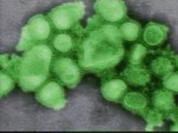 H1N1 Flu Infection Prevention