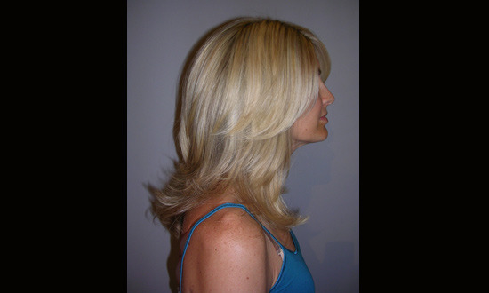 Blondes