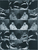 Erwartung II, Triptychon
