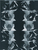 Erwartung III, Triptychon