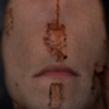 O_thumb
