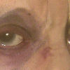 Keneyes1_thumb