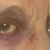 Keneyes1_tiny_square