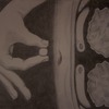 100_1687b_thumb