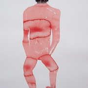 Bowed_legs_card