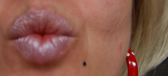 Beijo_inset