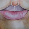 Lips_thumb