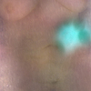 Schnee_thumb