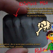 Dintele_meu_card