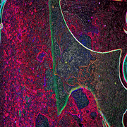 Intersect-r-500x500_card