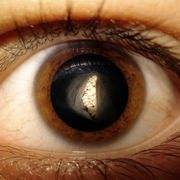 Eye_card
