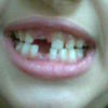 Bild021_thumb