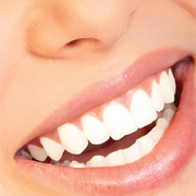 Teeth-whitening-bournemouth_card