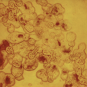 Cells_collograph_cropped_card