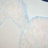Interval_series_schema_9_thumb