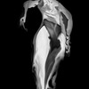 X-ray_6_thumb