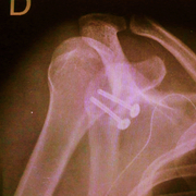 P1000361-3_card