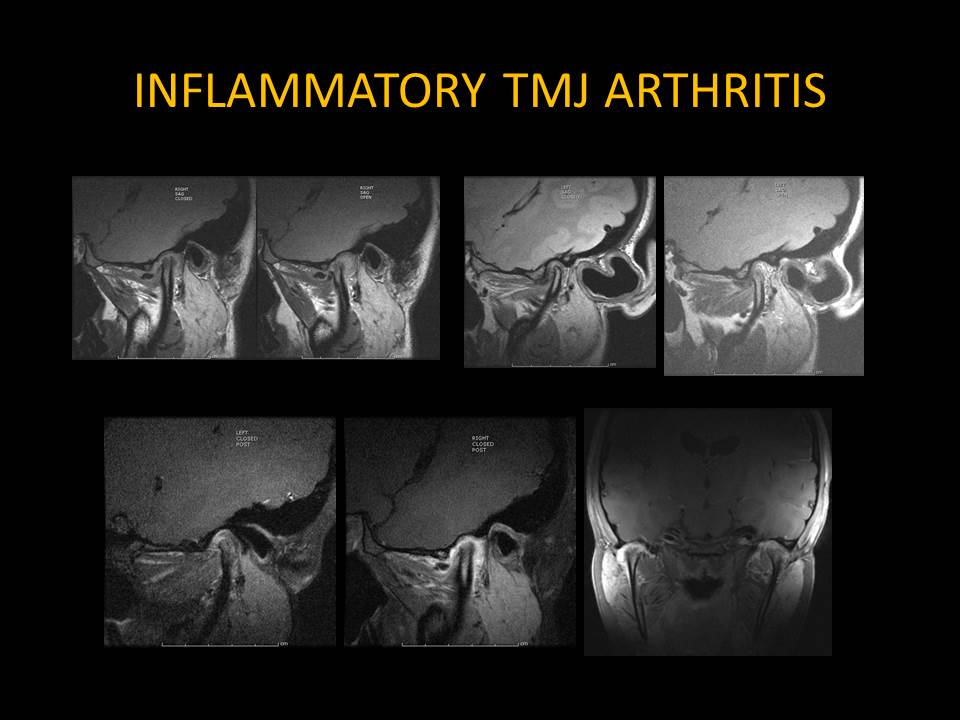 pictorial essay radiology pictorial essay