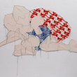 Thrombosenkelch_small