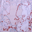 Bd12645143_square