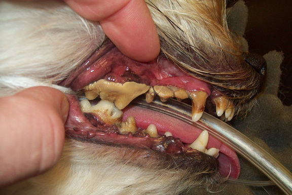 grade 3-4 dental