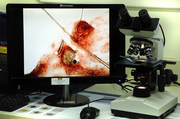 Demodex under the microscope