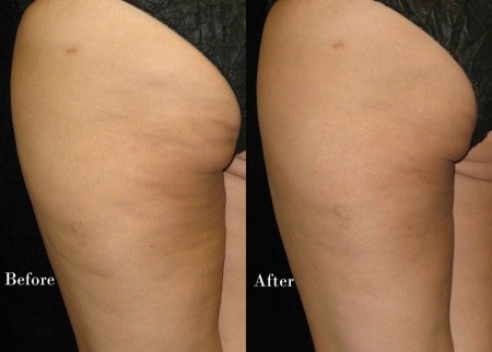 MiBella Wellness Center Deal Image