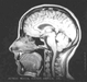Brain_medium