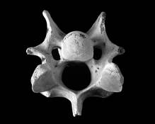 Bones_6