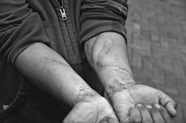 Schizophrenic_arms