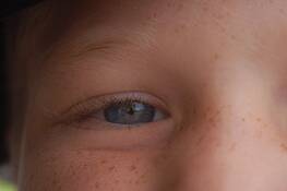 Blue_eye