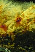 Shadowland_acetaminophen_crystal