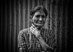 Modern_leper