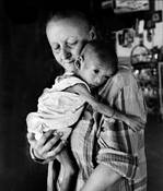 Child_with_aids