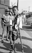 Kid_on_crutch