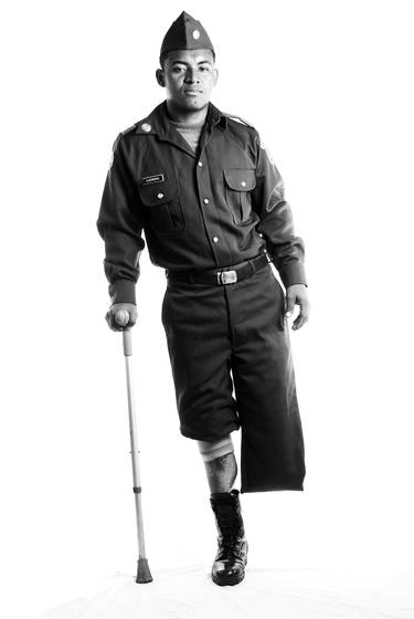 Landmine_victim_10
