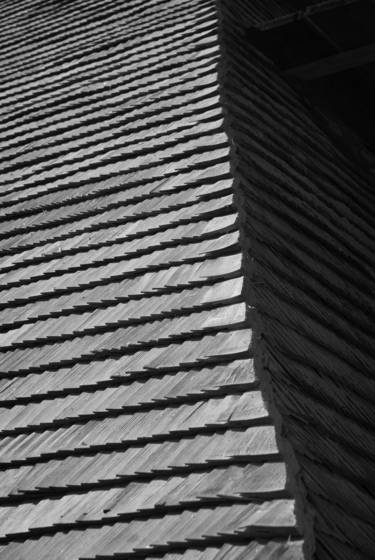 Shingles