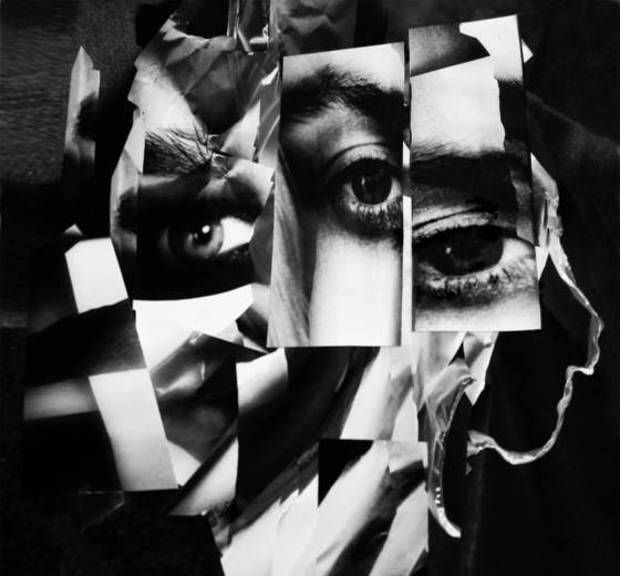 Fractures