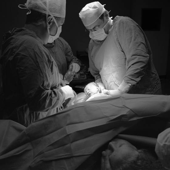 Caesarian_section